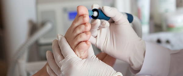 Лечение грибковой инфекции на ногтевой пластине 1